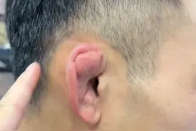 耳朵是摔跤形成的（俗称：饺子耳）古典摔跤运动员是摔跤里面力量最大的！！#摔跤 #饺子耳