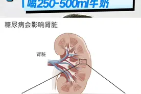 血糖高，怎么选牛奶？ #硬核健康科普行动 #糖尿病 #守护血糖健康指南 #高血糖 #糖尿病科普视频封面