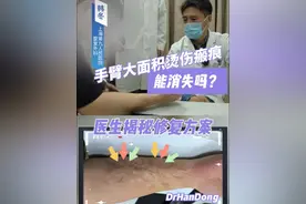 手臂大面积烧伤瘢痕能消失吗？医生揭秘修复方案。#大面积瘢痕 #瘢痕修复 #上海九院韩冬 #科普健康知识 #门诊日常