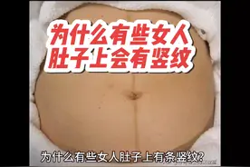 #科普 为什么有些女人肚子上会有道竖纹视频封面