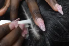 黑白夫妇沉浸式超清头皮油脂粒清洁#油脂粒 #头皮屑 #解压助眠视频封面