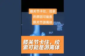 膝关节卡住、绞索，可能是膝关节游离体#运动损伤 #医学科普 #关节游离体 #膝关节疼痛 #膝盖疼痛 @抖音短视频视频封面
