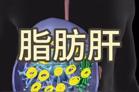 脂肪肝不仅胖子会得，瘦子一样会！脂肪肝是怎么形成的？ #脂肪肝 #肝硬化 #硬核科普健康行动 #内容启发搜索 #抖出健康知识宝藏视频封面