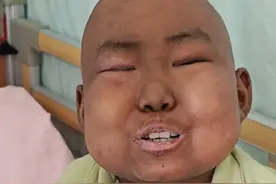 干杯，叔叔姨姨们陪一个呀！#9岁男孩患白血病4年多