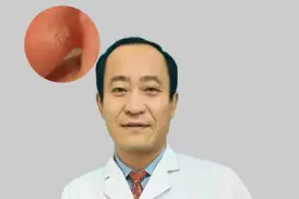 脚上长硬疙瘩是鸡眼吗？#鸡眼 #跖疣 #瘊子视频封面