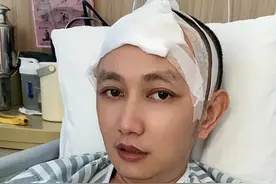 很多朋友想知道，补颅骨需要多少费用，能不能报销，我在这里说说用了很多吧，这仅供参考，因为每个地方都不同，总共费用是五万七，报销后自己出两万二左右。用的材料是peek的，希望能帮助想准备修补的朋友。#脑出血患者的康复之路 #颅骨修补 #peek视频封面