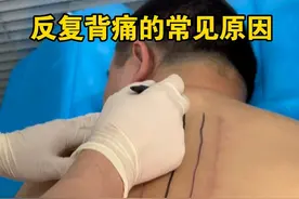反复背痛的常见原因#背痛 #背疼 #肌肉筋膜炎 #硬核健康科普行动视频封面
