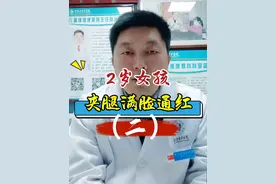 2岁女孩夹腿满脸通红（二）#医学科普 #夹腿综合征 #早发育 @儿保医生林丛助生长