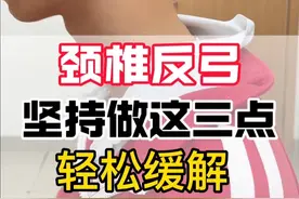颈椎反弓这样做可以轻松缓解脖子僵硬疼痛 经常低头出现颈椎反弓、弧度变直，导致脖子僵硬酸痛、头晕头痛，可以按这三点做，可以轻松缓解！#抖出健康知识宝藏 #颈椎反弓 #脖子酸痛 #脖子前倾 #骨科陈永和医生