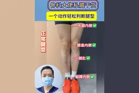 这个方法简单易学，只要跟着做，你就能立马知道自己的腿型是正常腿型还是x型腿（膝外翻）、O型腿（膝内翻）快来试试吧，让身边的朋友一起轻松get腿型知识#抖出健康知识宝藏 #解锁春日健康清单 #在抖音pick你的健康搭子   #腿型分析 #骨科医生