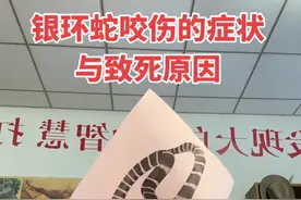 银环蛇咬伤的症状与致死原因 银环蛇咬伤症状包括局部麻木、头晕眼花、肌肉关节酸痛等，最终导致呼吸衰竭。被咬伤后应在伤口上方20-30厘米处捆扎，延缓中毒，避免挤压伤口。#银环蛇咬伤