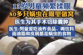 男童频繁揉眼80多只螨虫在眼里做窝视频封面