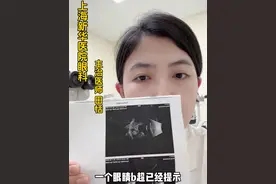 小小孩的视力怎么查？眼科医生来支招！#视力养护 #近视防控 #医学科普视频封面