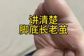 讲清楚脚底长老茧的原因，走路可以明显改善#步态 #纠正腿型视频封面