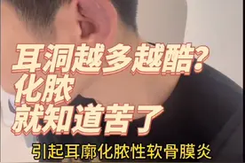 打耳洞导致耳廓化脓性软骨膜炎#打耳洞