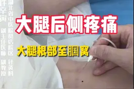 大腿后侧牵扯胀痛 #疼痛 #中医 #经络穴位 #针灸调理 #许辛寅