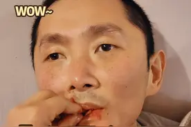 记录彭亚楼的咀嚼成长〡 看着他从植物人状态一路不断成长，越来越好，咀嚼的越来越有模有样了。从无咀嚼能力，到吞咽能力不断增强，一点点的训练他的咬合感觉，再到慢慢开始裹舌头，舌头从僵硬后缀，到越来越柔软灵活，咀嚼能力也开始越来越明显了。我从来不给彭亚楼拽舌头，因为我观察的结论：并不是彭亚楼有意识，因为长期不使用舌头，导致舌头僵硬，很难伸舌头，而是彭亚楼本来没意识，硬拽舌头，舌头容易损伤，根本性的问题并没有解决，所以，我采用的是多方面刺激他意识，让他在被动的刺激下，自主的伸舌头。比如：刺激他口腔内部痒痒，用美食刺激他，用各种口味的果汁刺激他。总之，就是想办法让他自己想吐舌头，伸舌头。彭亚楼现在经常无意识发声【哎呀哎呀】，吐字非常清楚，我分析，他的舌头问题不会太大，主要还是意识问题。 【我对彭亚楼的康复护理总结，仅供参考】 #彭亚楼煤气中毒康复日记 #七松家日记视频封面