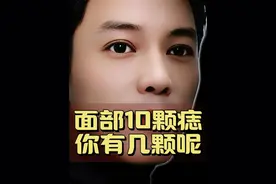✨面部的十颗痣，你有几颗呢？ #痣祛福来 #痣文化 #痣的位置和寓意图 #痣的含义 #痣的秘密