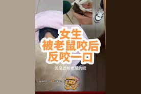 #老鼠 #社会百态 #真实事件 女子不慎被老鼠咬到手，感觉被挑衅反咬老鼠的头！医生：从业以来没见过先例，打了破伤风和狂犬疫苗@🌻努力睡大觉视频封面