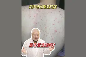 天气一热，后背就会长密密麻麻的红疙瘩，有时还伴有瘙痒！这可能是真菌感染引起是#马拉色菌毛囊炎 ，越抠长越多！#抖出健康知识宝藏 #变美 #痘痘 #夏天