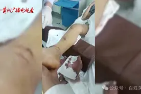 被“女鬼”吓了？17岁少年玩密室逃脱摔成骨折，商家：我们只认60%责任图片