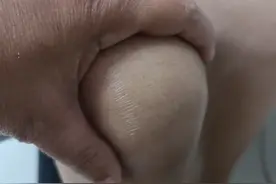 氨糖是软骨“保护剂”，长期服用可以修复关节？这样吃才正确图片