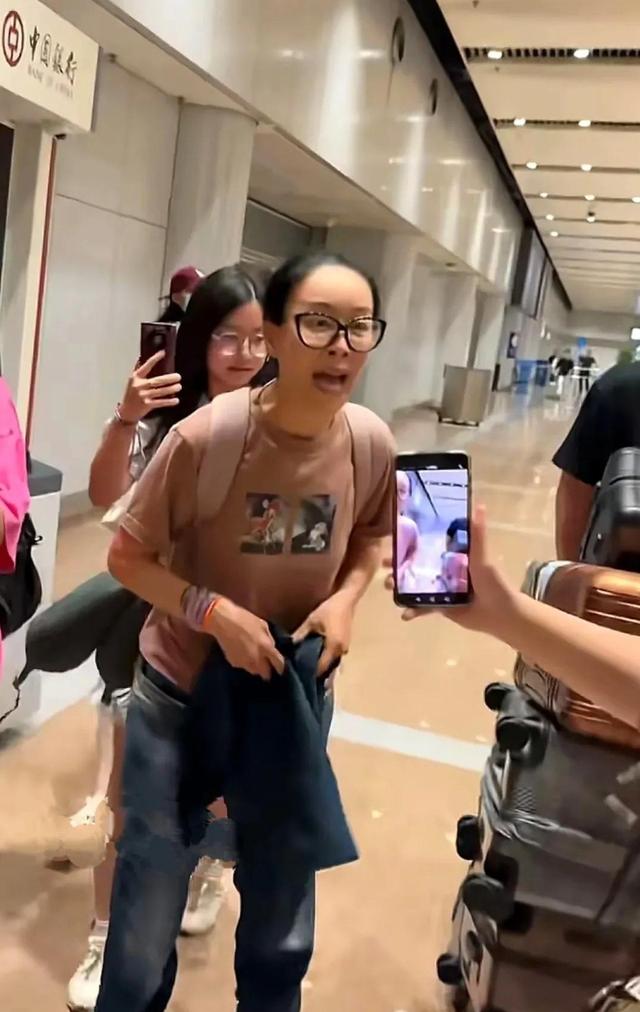 机场偶遇那英，脑门儿是填充了还是植发了？又肿又鼓不自然
