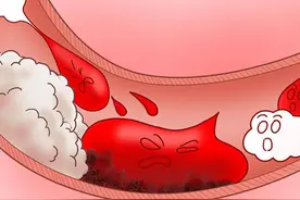 备孕先“排淤”！山楂和它一起煮，宫寒、肌瘤、炎症统统绕道走图片