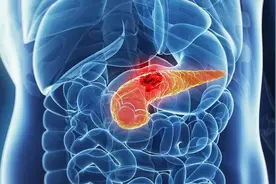 越来越多的人查出胰腺炎！医生提醒：冰箱久置的3物，或是"凶手"图片