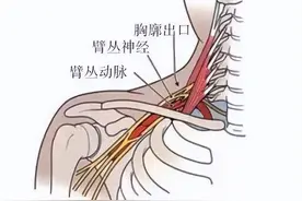 感觉肢体麻木，到底是哪儿出了问题？图片