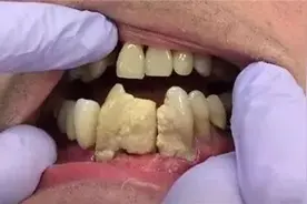 自掏腰包测评国货最强牙粉！牙石牙黄就选它！来看看你选对了吗？图片