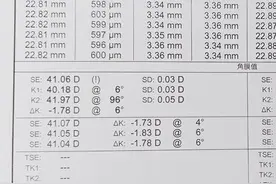 眼科医生带你看检查单！图片