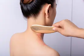 头皮屑总反复？中医教你2招，穴位疗法加外洗，去屑止痒头皮清爽图片