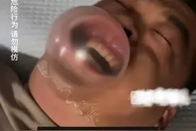 笑死！黑龙江女子给老公买止鼾神器，差点突破封印！网友：像谋杀图片