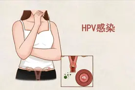 关于HPV的真相，每个人都必须了解！做好这5点，远离HPV感染！图片