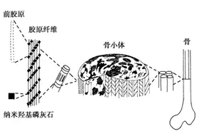 骨填充修复材料知识精华大揭秘：分类、特点、价格、集采全知晓！图片
