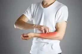 当归加一物，让湿疹、荨麻疹、毛囊炎等各种皮肤病，望风而逃图片