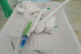 好后悔！修修补补，前后5次，才算把牙嵌体给整好，还不如戴牙套图片