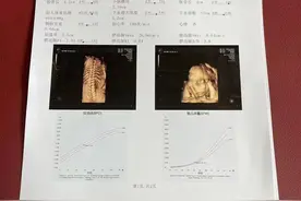 孕22周，四维检查一次通过，我的小宝很配合！图片