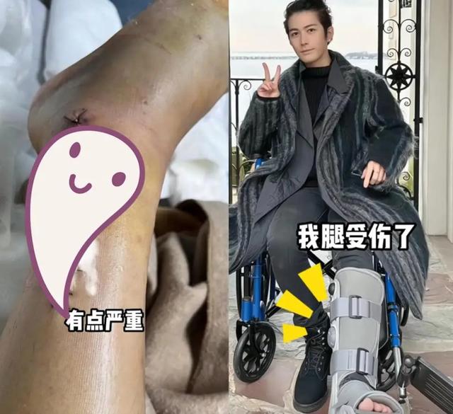 挣再多钱有啥用？两年4次手术，11部作品被下架，今生活无法自理