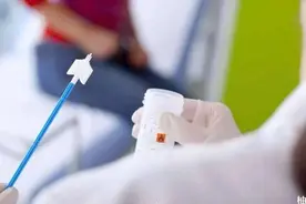 非典型的鳞状细胞不能明确意义是癌前变吗？图片