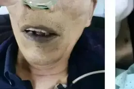 一碗下肚，中毒全身变“紫”！这种下饭菜吃不好能致命→图片