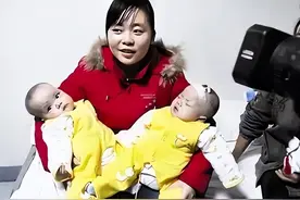 湖北女子生下全国首例连体女婴，同用排泄系统，14年后却再迎悲剧图片