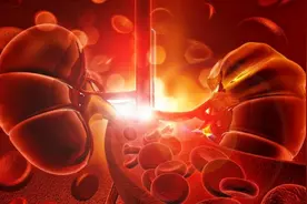 肌酐升高是怎么回事？医师为您讲清原理，给出解决方案！图片