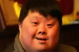人世观察笔录2：“守村人”和“唐氏儿”，他们的存在没那么简单!图片