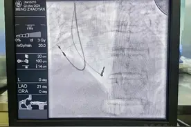 医师节系列 | 哈医大一院“杰青”风采 老年病科尹德春：植入型心律转复除颤器守护老年室速室颤患者生命健康图片