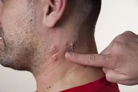 右肩疼痛3个月确诊肺癌！肩膀疼不一定是肩周炎，这3种疾病可致命图片