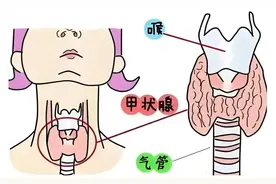 甲减是一种什么病？患者最关心的5个问题，一次性给你说清楚！图片