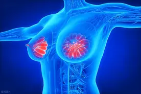 乳腺癌恶化时，千万警惕4个部位！除了疼痛，这些症状也在提示你图片