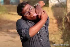 7种罕见的人体特征，拥有一个或是“天选之人”，看你占了几种？图片